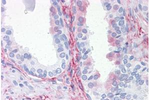 Human Prostate: Formalin-Fixed, Paraffin-Embedded (FFPE) (Aquaporin 8 antibody  (AA 1-255))