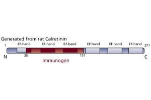Image no. 3 for anti-Calbindin 2 (CALB2) (AA 38-151) antibody (ABIN968244) (Calretinin antibody  (AA 38-151))