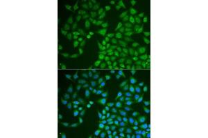 Immunofluorescence analysis of U2OS cells using PNLIP antibody (ABIN6128521, ABIN6145838, ABIN6145840 and ABIN6222025). (PNLIP antibody  (AA 166-465))