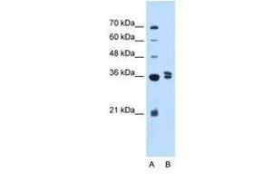 Image no. 1 for anti-Transcription Factor B1, Mitochondrial (TFB1M) (AA 151-200) antibody (ABIN324363) (TFB1M antibody  (AA 151-200))