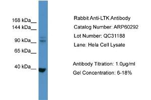 WB Suggested Anti-LTK  Antibody Titration: 0. (LTK antibody  (N-Term))