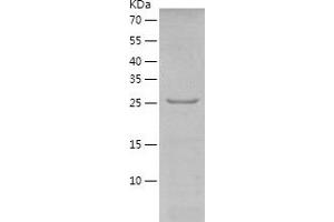 Western Blotting (WB) image for Proline Synthetase Co-Transcribed (PROSC) (AA 1-275) protein (His tag) (ABIN7124593) (PROSC Protein (AA 1-275) (His tag))
