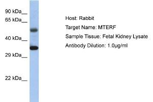 Host: Rabbit Target Name: MTERF1 Sample Tissue: Human Fetal Kidney Antibody Dilution: 1ug/ml