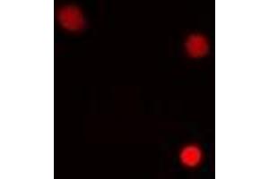 Immunofluorescent analysis of HMG-20A staining in MCF7 cells. (HMG20A antibody)