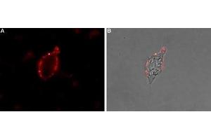 Immunocytochemistry (ICC) image for anti-Sodium Channel, Voltage-Gated, Type IX, alpha Subunit (SCN9A) (AA 1533-1543), (Extracellular) antibody (ABIN7043649)