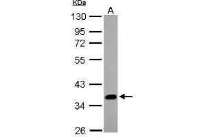 WB Image Sample (20 ug of whole cell lysate) A: A431 , 10% SDS PAGE antibody diluted at 1:1000 (SOX2 antibody)