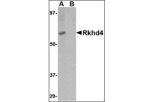Western blot analysis of Rkhd4 in SK-N-SH cell lysate with this product at 1 μg/ml in (A) the absence and (B) the presence of blocking peptide.