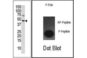 Image no. 1 for anti-Jun Proto-Oncogene (JUN) (pSer63) antibody (ABIN358111)