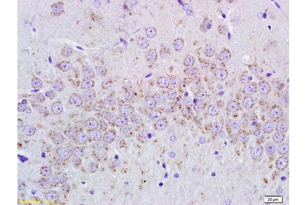 Cyclic GMP antibody