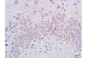Formalin-fixed and paraffin embedded rat brain tissue labeled with Anti-cGMP Polyclonal Antibody, Unconjugated (ABIN750733) at 1:400, followed by conjugation to the secondary antibody and DAB staining (Cyclic GMP antibody)
