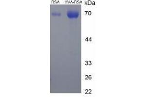Image no. 2 for Homovanillic Acid (HVA) protein (BSA) (ABIN1880189) (Homovanillic Acid Protein (HVA) (BSA))