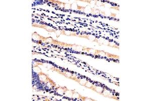 Immunohistochemical analysis of paraffin-embedded H. (UBE2K antibody  (AA 109-139))