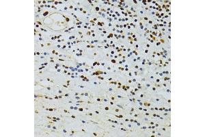 Immunohistochemistry of paraffin-embedded human vermiform appendix using ALYREF antibody (ABIN5973579) at dilution of 1/100 (40x lens). (THO Complex 4 antibody)