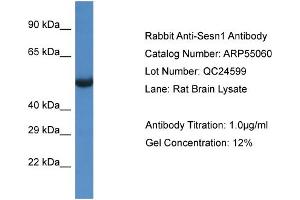 Western Blotting (WB) image for anti-Sestrin 1 (SESN1) (C-Term) antibody (ABIN2786033) (SESN1 antibody  (C-Term))