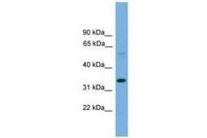 Transmembrane 7 Superfamily Member 4 (TM7SF4) (AA 101-150) antibody