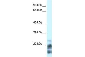 WB Suggested Anti-MDP-1 Antibody Titration: 0.