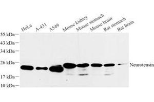 Western blot analysis of Neurotensin (ABIN7074827) at dilution of 1: 1000 (Neurotensin antibody)