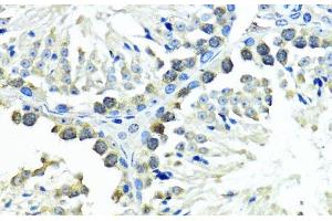 Immunohistochemistry (Paraffin-embedded Sections) (IHC (p)) image for anti-Small Ubiquitin Related Modifier Protein 1 (SUMO1) antibody (ABIN7260199)