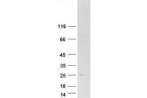Western Blotting (WB) image for Apolipoprotein B mRNA Editing Enzyme, Catalytic Polypeptide-Like 3C (APOBEC3C) protein (Myc-DYKDDDDK Tag) (ABIN2714812)