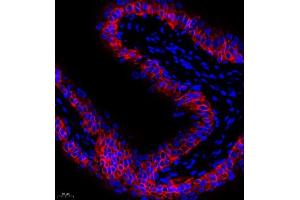 Immunofluorescence of paraffin embedded rat bladder using CK13 (ABIN7074412) at dilution of 1:1500 (400x lens) (Cytokeratin 13 antibody  (N-Term))