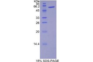 SDS-PAGE (SDS) image for Noggin (NOG) (AA 28-144) protein (His tag,MBP tag) (ABIN2123790) (NOG Protein (AA 28-144) (His tag,MBP tag))