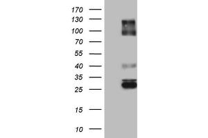 Western Blotting (WB) image for anti-Immunoglobulin Superfamily, Member 11 (IGSF11) (AA 23-241) antibody (ABIN2674600)