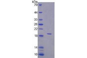 SDS-PAGE analysis of Human Corticosteroid Binding Globulin (CBG) Protein.