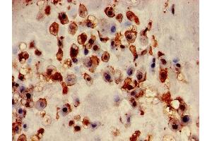 Immunohistochemistry of paraffin-embedded human placenta tissue using ABIN7153453 at dilution of 1:100 (Galectin 3 antibody  (AA 2-250))