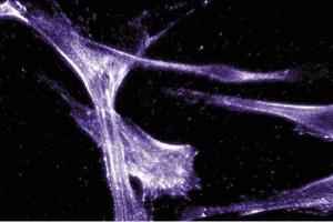 Immunofluorescent staining of Hs68 cells with anti-Actin Ab-5. (Actin antibody)