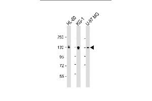 All lanes : Anti-DEPD5 Antibody (C-term) at 1:2000 dilution Lane 1: HL-60 whole cell lysate Lane 2: KG-1 whole cell lysate Lane 3: U-87 MG whole cell lysate Lysates/proteins at 20 μg per lane. (DEPDC5 antibody  (AA 1404-1432))
