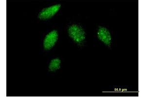 Immunofluorescence of purified MaxPab antibody to CCNG1 on HeLa cell. (Cyclin G1 antibody  (AA 1-295))