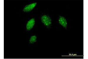 Immunofluorescence of purified MaxPab antibody to CCNG1 on HeLa cell. (Cyclin G1 antibody  (AA 1-295))