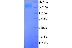 SDS-PAGE (SDS) image for Glucokinase (Hexokinase 4) Regulator (GCKR) (AA 1-625), (full length) protein (His tag) (ABIN5714340) (GCKR Protein (AA 1-625, full length) (His tag))