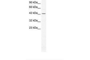 Image no. 1 for anti-General Transcription Factor IIA, 1-Like (GTF2A1L) (AA 86-135) antibody (ABIN6736279) (GTF2A1L antibody  (AA 86-135))