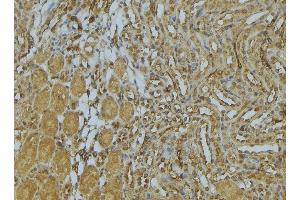 ABIN6273032 at 1/100 staining Mouse kidney tissue by IHC-P. (AP1M1 antibody  (Internal Region))