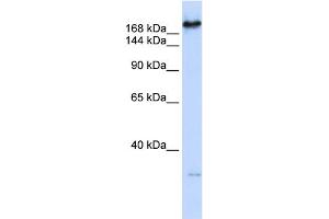 WB Suggested Anti-CAD Antibody Titration:  0. (CAD antibody  (C-Term))