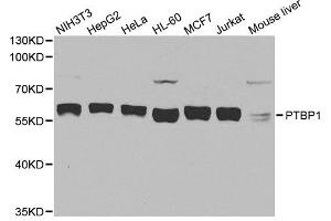Western blot analysis of extracts of various cell lines, using PTBP1 antibody. (PTBP1 antibody  (AA 1-100))