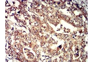 Immunohistochemistry (IHC) image for anti-Elastase, Neutrophil Expressed (ELANE) (AA 140-267) antibody (ABIN5611333)