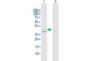 Western Blot analysis of SIRT5 expression in transfected 293T cell line by SIRT5 MaxPab polyclonal antibody. (SIRT5 antibody  (AA 1-310))