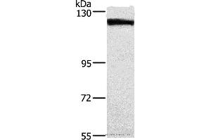Western blot analysis of Human tongue cancer tissue, using DSG1 Polyclonal Antibody at dilution of 1:750 (Desmoglein 1 antibody)