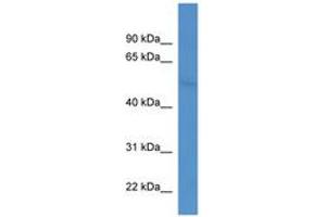 Image no. 1 for anti-Coronin, Actin Binding Protein, 2B (CORO2B) (AA 275-324) antibody (ABIN6746343) (CORO2B antibody  (AA 275-324))