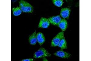 IF analysis of ITCH/AIP4 using anti-ITCH/AIP4 antibody (ABIN7600264). (ITCH antibody  (AA 17-358))