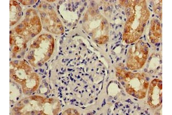 Chromosome 1 Open Reading Frame 84 (C1orf84) (AA 2396-2517) antibody