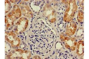 Immunohistochemistry of paraffin-embedded human kidney tissue using ABIN7166170 at dilution of 1:100 (Chromosome 1 Open Reading Frame 84 (C1orf84) (AA 2396-2517) antibody)