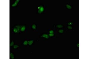 Immunofluorescent analysis of HepG2 cells using ABIN7167020 at dilution of 1:100 and Alexa Fluor 488-congugated AffiniPure Goat Anti-Rabbit IgG(H+L) (RACGAP1 antibody  (AA 86-331))
