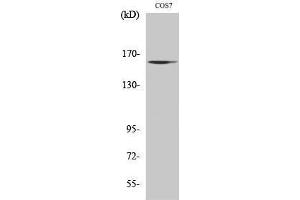 Western Blotting (WB) image for anti-MutS Homolog 6 (E. Coli) (MSH6) (Internal Region) antibody (ABIN3184960)