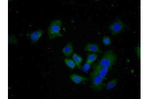 Detection of FAPa in Human HepG2 cell using Polyclonal Antibody to Fibroblast Activation Protein Alpha (FAPa) (FAP antibody  (AA 542-761))