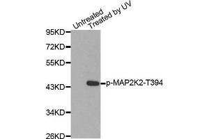 Western blot analysis of extracts from HepG2 cells using Phospho-MAP2K2-T394 antibody. (MEK2 antibody  (pThr394))