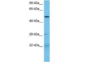 Host:  Mouse  Target Name:  PAX3  Sample Tissue:  Mouse Small Intestine  Antibody Dilution:  1ug/ml (Paired Box 3 antibody  (N-Term))