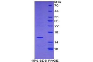 SDS-PAGE analysis of Human Tryptase delta 1 Protein. (TPSD1 Protein)